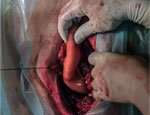 Weichteilchirurgie
