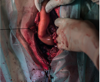 Weichteilchirurgie