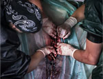 Weichteilchirurgie